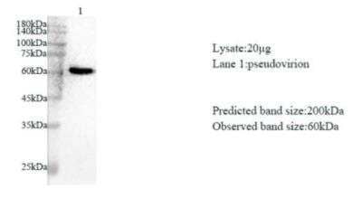 Western Blot: SARS-CoV-2 nsp3 Antibody [NBP3-07966] - Various lysates were subjected to SDS-PAGE followed by western blot with SARS-CoV-2 (2019-nCoV) NSP3 Protein antibody at dilution of 1:1000.