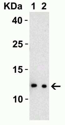 Western Blot: SARS-CoV-2 nsp8 Antibody [NBP3-07047] - Western Blot Validation with SARS-CoV-2 nsp8 Protein. Loading: 30 ng per lane of SARS-CoV-2 nsp8 protein. Antibodies: SARS-CoV-2 nsp8 (NBP3-07047), 1h incubation at RT in 5% NFDM/TBST. Secondary: Goat anti-rabbit IgG HRP conjugate at 1:10000 dilution. Lane 1: 0.5 ug/ml and  Lane 2: 1 ug/ml