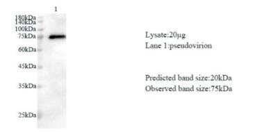 Western Blot: SARS-CoV-2 nsp8 Antibody [NBP3-07968] - Various lysates were subjected to SDS-PAGE followed by western blot with SARS-CoV-2 (2019-nCoV) NSP8 Protein antibody at dilution of 1:1000.