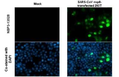 Immunocytochemistry/Immunofluorescence: SARS-CoV NSP8 Antibody (5A10) [NBP3-13528] - SARS-CoV / SARS-CoV-2 (COVID-19) NSP8 antibody [5A10] detects SARS-CoV / SARS-CoV-2 (COVID-19) NSP8 protein by immunofluorescent analysis. Sample: Mock and transfected 293T cells were fixed in 4% paraformaldehyde at RT for 15 min. Green: SARS-CoV / SARS-CoV-2 (COVID-19) NSP8 stained by SARS-CoV / SARS-CoV-2 (COVID-19) NSP8 antibody [5A10] (NBP3-13528) diluted at 1:1000. Blue: Fluoroshield with DAPI.