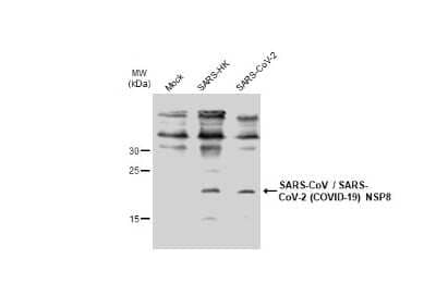 Western Blot: SARS-CoV NSP8 Antibody (5A10) [NBP3-13528] - Non-infected (-) and infected (+, 48h pl MOI 0.01) whole cell extracts were separated by SDS-PAGE, and the membrane was blotted with SARS-CoV / SARS-CoV-2 (COVID-19) NSP8 antibody [5A10] (NBP3-13528) diluted at 1:1000.