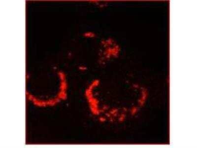 Immunocytochemistry/Immunofluorescence: SARS-CoV nsp13 Antibody [NBP2-89168] - Immunofluorescence microscopy using anti-SARS-CoV nsp13 antibody, 6-h post infection Vero-E6 cells. For detection Cy3 conjugated Goat-anti-Rabbit IgG MX (NB120-6939) was used.