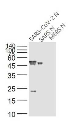 Western Blot: SARS Nucleocapsid Protein Antibody (14B3D) [NBP3-07063] - Western Blot Validation of SARS Nucleocapsid Antibody. Lane 1: SARS-CoV-2 Nucleocapsid protein, Lane 2: recombinant SARS Nucleocapsid protein, Lane 3: MERS Nucleocapsid protein probed with SARS Nucleocapsid Antibody [14B3D], NBP3-07063, at 1:1000 dilution and 4C overnight incubation. Followed by conjugated secondary antibody incubation at 1:20000 for 60 min at 37C.