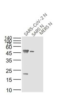 Western Blot: SARS Nucleocapsid Protein Antibody (8G8A) [NBP3-07064] - Western Blot Validation of SARS Nucleocapsid Antibody. Lane 1: SARS-CoV-2 Nucleocapsid protein, Lane 2: recombinant SARS Nucleocapsid Protein and Lane 3: MERS Nucleocapsid protein probed with SARS Nucleocapsid Antibody [8G8A], NBP3-07064, at 1:1000 dilution and 4C overnight incubation. Followed by conjugated secondary antibody incubation at 1:20000 for 60 min at 37C.