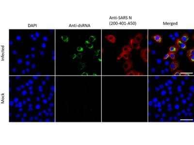 Immunocytochemistry/Immunofluorescence: SARS Nucleocapsid Protein Antibody [NBP2-44205] - Immunofluorescence assay using Rabbit Anti-SARS-CoV Nucleocapsid (N) Antibody, showing viral protein synthesis. VeroE6 cells were infected with rSARS-CoV-2. Mock: non-infected cells. At 48 h.p.i, cells were fixed and prepared for immunofluorescence staining with primary antibodies directed against double-stranded RNA (dsRNA) [green] and SARS-CoV Nucleocapsid (N) [red]. Nuclear Counterstain DAPI [blue].