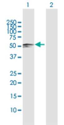Western Blot: SARS2 Antibody [H00054938-D01P] - Analysis of SARS2 expression in transfected 293T cell line by SARS2 polyclonal antibody.Lane 1: SARS2 transfected lysate(58.30 KDa).Lane 2: Non-transfected lysate.