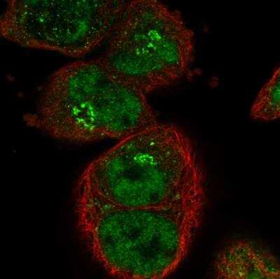 Immunocytochemistry/Immunofluorescence: SART1 Antibody [NBP1-89022] - Staining of human cell line A-431 shows localization to nuclear speckles & the Golgi apparatus. Antibody staining is shown in green.