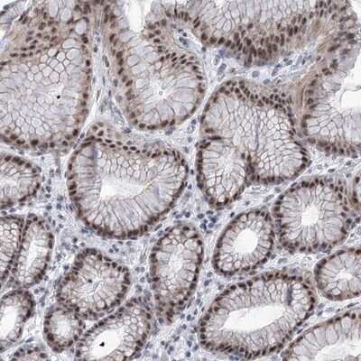 Immunohistochemistry-Paraffin: SART1 Antibody [NBP1-89023] - Staining of human stomach shows strong nuclear positivity in glandular cells.
