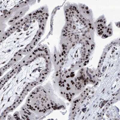 Immunohistochemistry-Paraffin: SART1 Antibody [NBP1-89024] - Staining of human placenta shows strong nuclear positivity in trophoblastic cells.
