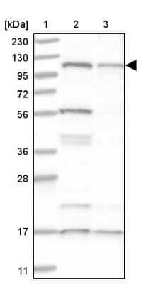 Western Blot: SART1 Antibody [NBP1-89022] - Lane 1: Marker [kDa] 230, 130, 95, 72, 56, 36, 28, 17, 11Lane 2: Human cell line RT-4Lane 3: Human cell line U-251MG