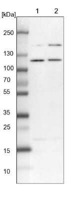 Western Blot: SART1 Antibody [NBP1-89022] - Lane 1: NIH-3T3 cell lysate (Mouse embryonic fibroblast cells)Lane 2: NBT-II cell lysate (Rat Wistar bladder tumour cells)