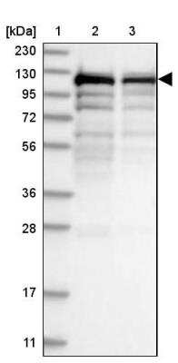 Western Blot: SART1 Antibody [NBP1-89023] - Lane 1: Marker  [kDa] 230, 130, 95, 72, 56, 36, 28, 17, 11.  Lane 2: Human cell line RT-4.  Lane 3: Human cell line U-251MG.