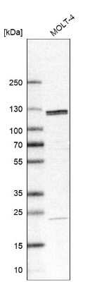 Western Blot SART1 Antibody - BSA Free