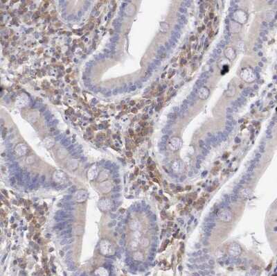 Immunohistochemistry-Paraffin SASH3 Antibody