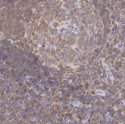 Immunohistochemistry-Paraffin SASH3 Antibody