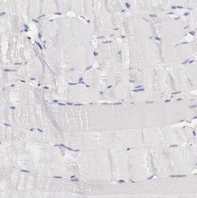 Immunohistochemistry-Paraffin SASH3 Antibody