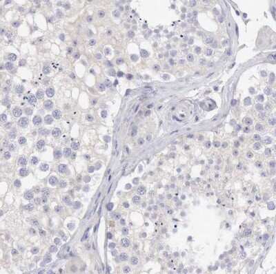 Immunohistochemistry-Paraffin: SASH3 Antibody [NBP1-92364] - Staining of human testis shows no positivity in cells in seminiferous ducts as expected.