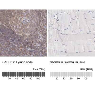 Immunohistochemistry-Paraffin: SASH3 Antibody [NBP1-92364] - Staining in human lymph node and skeletal muscle tissues using NBP1-92364 antibody. Corresponding SASH3 RNA-seq data are presented for the same tissues.