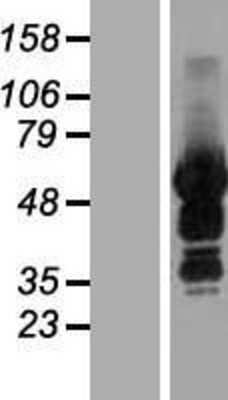 Western Blot: SASH3 Overexpression Lysate (Adult Normal) [NBL1-15697] Left-Empty vector transfected control cell lysate (HEK293 cell lysate); Right -Over-expression Lysate for SASH3.