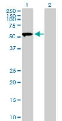 Western Blot SASS6 Antibody