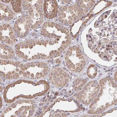 Immunohistochemistry-Paraffin: SAT1 Antibody [NBP2-37947] - Staining of human kidney shows moderate cytoplasmic positivity in cells in tubules.