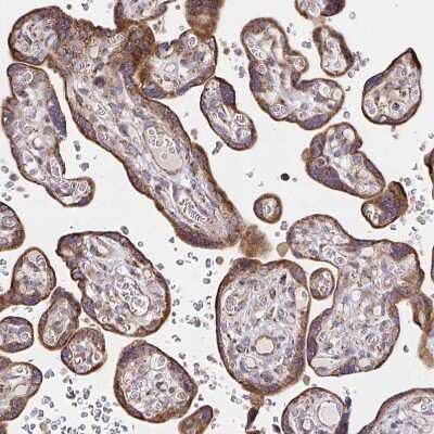 Immunohistochemistry-Paraffin: SAT1 Antibody [NBP2-37947] - Staining of human placenta shows strong cytoplasmic positivity in trophoblastic cells.