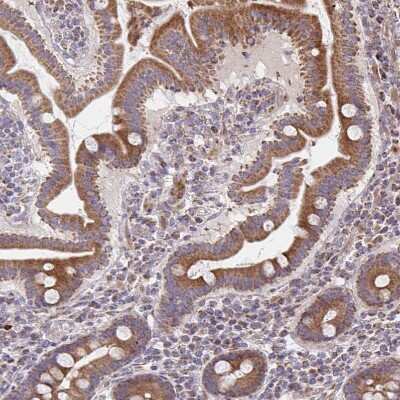 Immunohistochemistry-Paraffin: SAT1 Antibody [NBP2-37947] - Staining of human upper gastrointestinal shows moderate cytoplasmic positivity in glandular cells.