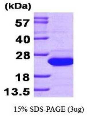 SDS-Page: Recombinant Human SAT1 Protein [NBP1-30198] - Diamine N-acetyltransferase 1, 22.1 kDa (191aa), confirmed by MALDI-TOF with a purity of 95% by SDS - PAGE