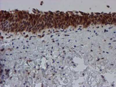 Immunohistochemistry-Paraffin: SAT2 Antibody (1C9) [NBP2-01998] - Staining of paraffin-embedded Human bladder tissue using anti-SAT2 mouse monoclonal antibody.