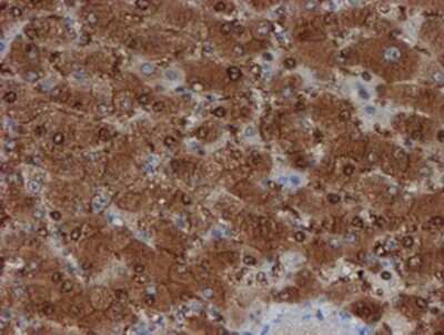 Immunohistochemistry-Paraffin: SAT2 Antibody (1C9) [NBP2-01998] - Staining of paraffin-embedded Human liver tissue using anti-SAT2 mouse monoclonal antibody.