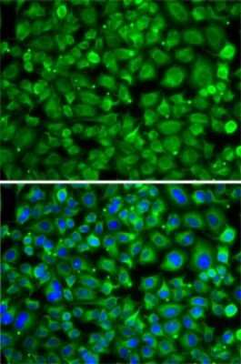 Immunocytochemistry/Immunofluorescence: SAT2 Antibody [NBP3-04471] - Analysis of A-549 cells using SAT2 antibody . Blue: DAPI for nuclear staining.