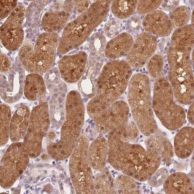 Immunohistochemistry: SAT2 Antibody [NBP2-49244] - Staining of human kidney shows cytoplasmic and nuclear positivity in cells in tubules.