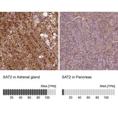 <b>Orthogonal Strategies Validation. </b>Immunohistochemistry-Paraffin: SAT2 Antibody [NBP1-80722] - Staining in human adrenal gland and pancreas tissues using anti-SAT2 antibody. Corresponding SAT2 RNA-seq data are presented for the same tissues.