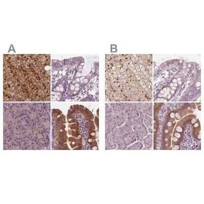 <b>Independent Antibodies Validation. </b>Immunohistochemistry-Paraffin: SAT2 Antibody [NBP1-80722] - Staining of human adrenal gland, colon, pancreas and small intestine using Anti-SAT2 antibody NBP1-80722 (A) shows similar protein distribution across tissues to independent antibody NBP2-49244 (B).