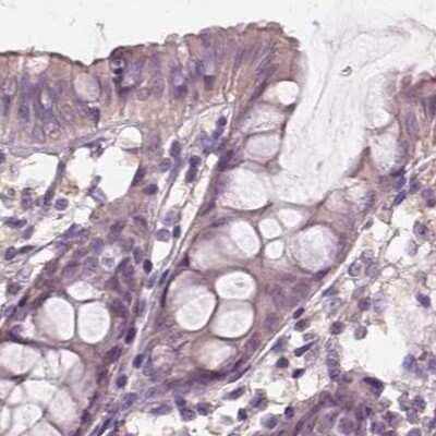 Immunohistochemistry-Paraffin: SAT2 Antibody [NBP1-80722] - Staining of human colon.