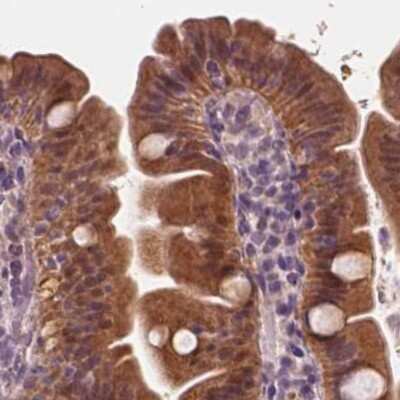 Immunohistochemistry-Paraffin: SAT2 Antibody [NBP1-80722] - Staining of human small intestine.