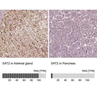 <b>Orthogonal Strategies Validation. </b>Immunohistochemistry-Paraffin: SAT2 Antibody [NBP2-49244] - Staining in human adrenal gland and pancreas tissues using anti-SAT2 antibody. Corresponding SAT2 RNA-seq data are presented for the same tissues.