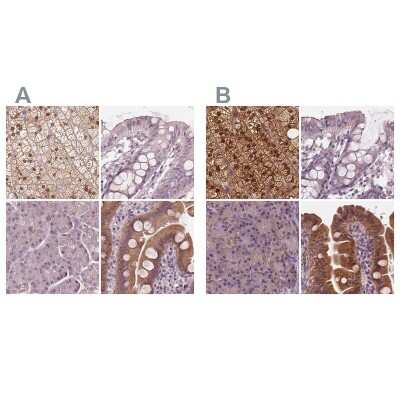 <b>Independent Antibodies Validation. </b>Immunohistochemistry-Paraffin: SAT2 Antibody [NBP2-49244] - Staining of human adrenal gland, colon, pancreas and small intestine using Anti-SAT2 antibody NBP2-49244 (A) shows similar protein distribution across tissues to independent antibody NBP1-80722 (B).