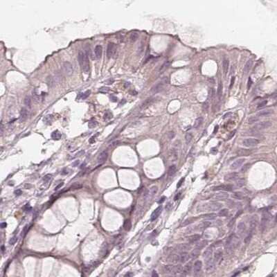 Immunohistochemistry-Paraffin: SAT2 Antibody [NBP2-49244] - Staining of human colon.