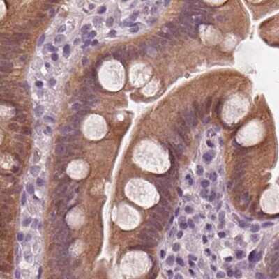 Immunohistochemistry-Paraffin: SAT2 Antibody [NBP2-49244] - Staining of human small intestine.