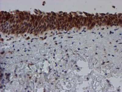 Immunohistochemistry: SAT2 Antibody (OTI1C9) - Azide and BSA Free [NBP2-73990] - Staining of paraffin-embedded Human bladder tissue using anti-SAT2 mouse monoclonal antibody.