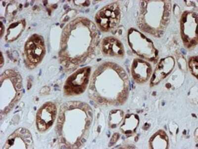 Immunohistochemistry: SAT2 Antibody (OTI1C9) - Azide and BSA Free [NBP2-73990] - Staining of paraffin-embedded Human Kidney tissue using anti-SAT2 mouse monoclonal antibody.