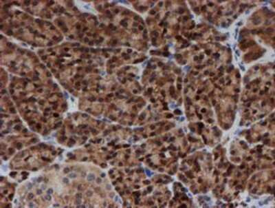 Immunohistochemistry: SAT2 Antibody (OTI1C9) - Azide and BSA Free [NBP2-73990] - Staining of paraffin-embedded Human pancreas tissue using anti-SAT2 mouse monoclonal antibody.