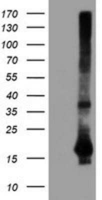 Western Blot: SAT2 Antibody (OTI1C9) - Azide and BSA Free [NBP2-73990] - HEK293T cells were transfected with the pCMV6-ENTRY control (Left lane) or pCMV6-ENTRY SAT2 (Right lane) cDNA for 48 hrs and lysed. Equivalent amounts of cell lysates (5 ug per lane) were separated by SDS-PAGE and immunoblotted with anti-SAT2.