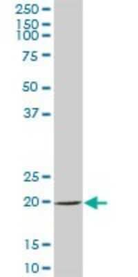 Western Blot: SAT2 Antibody [H00112483-B01P] - Analysis of SAT2 expression in human placenta.