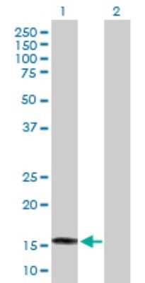 Western Blot: SAT2 Antibody [H00112483-B01P] - Analysis of SAT2 expression in transfected 293T cell line by SAT2 polyclonal antibody.  Lane 1: SAT2 transfected lysate(18.7 KDa). Lane 2: Non-transfected lysate.