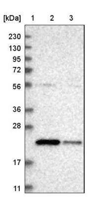 Western Blot: SAT2 Antibody [NBP1-80722] - Lane 1: Marker  [kDa] 230, 130, 95, 72, 56, 36, 28, 17, 11.  Lane 2: Human cell line RT-4.  Lane 3: Human cell line U-251MG sp