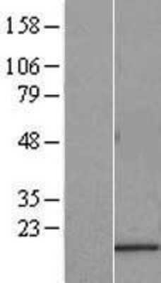 Western Blot: SAT2 Overexpression Lysate (Adult Normal) [NBL1-15699] Left-Empty vector transfected control cell lysate (HEK293 cell lysate); Right -Over-expression Lysate for SAT2.