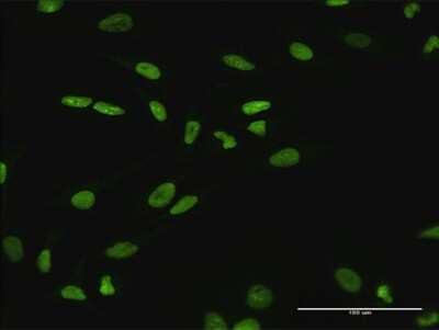 Immunocytochemistry/Immunofluorescence: SATB1 Antibody [H00006304-B01P] - Analysis of purified antibody to SATB1 on HeLa cell. (antibody concentration 10 ug/ml)