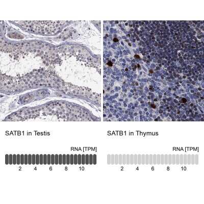 Immunocytochemistry/Immunofluorescence: SATB1 Antibody [NBP3-17001] - Analysis in human testis and thymus tissues using Anti-SATB1 antibody. Corresponding SATB1 RNA-seq data are presented for the same tissues.